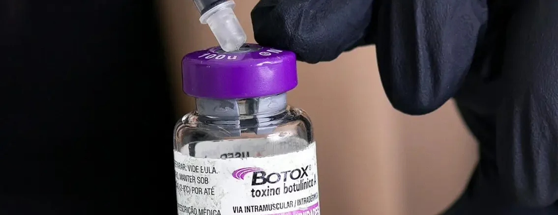 Mano con guante negro cargando jeringa en frasco de Botox toxina botulínica Allergan 100 unidades, preparación para tratamiento de rinomodelación en clínica estética Dr. Perdomo