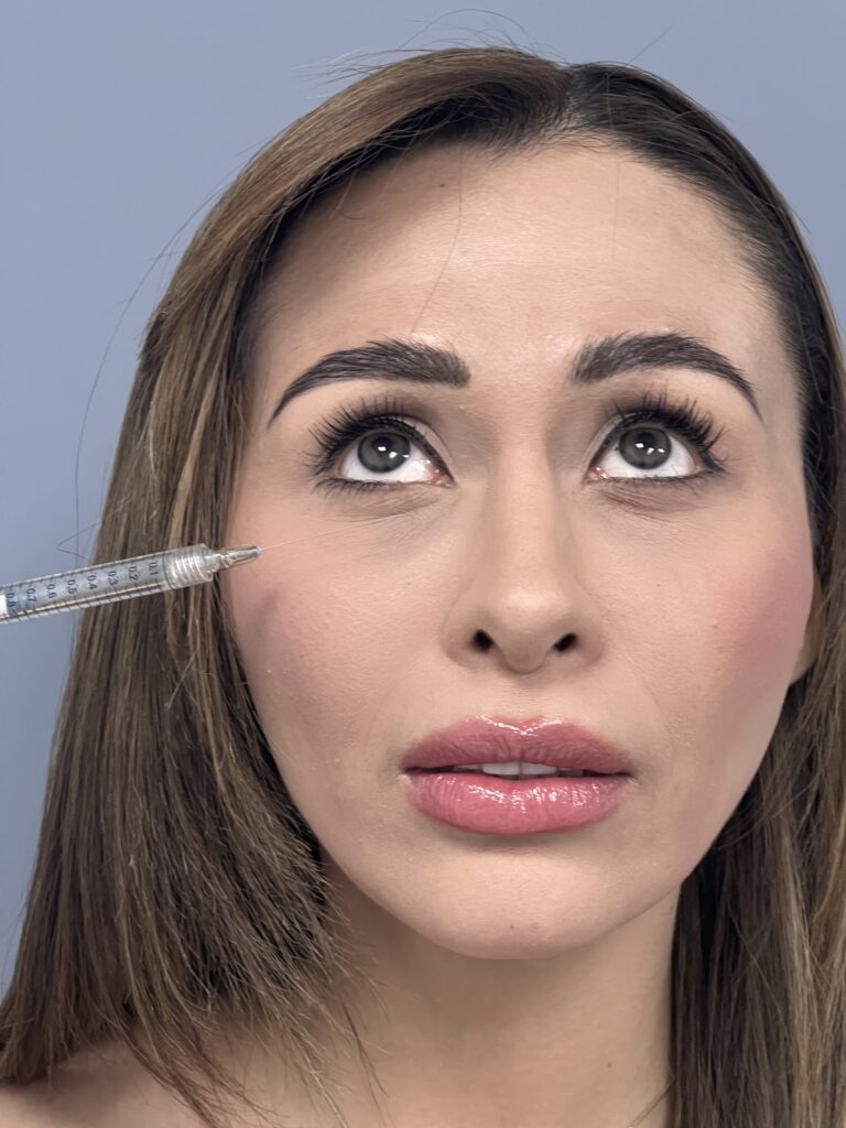 botox
