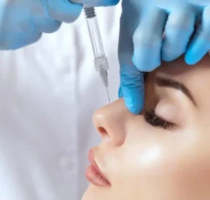 Médico aplicando relleno de ácido hialurónico en dorso nasal para rinomodelación sin cirugía, tratamiento estético para corregir y estilizar la nariz en clínica Dr. Perdomo