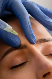 Aplicación de baby bótox en dosis preventivas en entrecejo de paciente joven, técnica de toxina botulínica para prevenir arrugas en clínica estética Dr. Perdomo