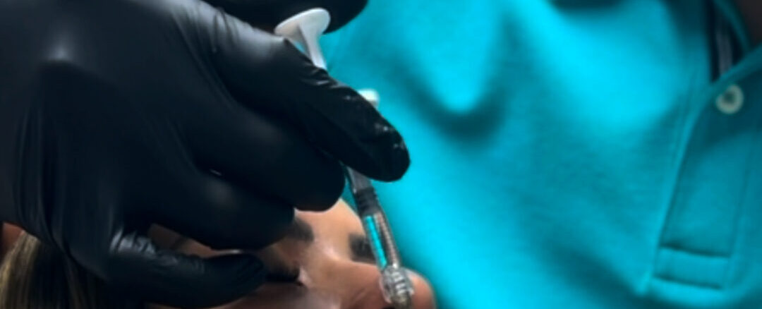 Dr. Perdomo aplicando relleno dérmico con ácido hialurónico en labios de paciente, tratamiento estético natural sin efecto cara congelada en clínica Dr. Perdomo