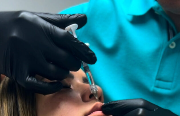 Dr. Perdomo aplicando relleno dérmico con ácido hialurónico en labios de paciente, tratamiento estético natural sin efecto cara congelada en clínica Dr. Perdomo