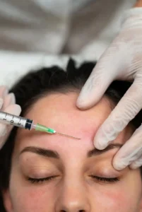 Médico aplicando inyección de toxina botulínica en frente de paciente femenina para reducir arrugas, procedimiento estético en clínica Dr. Perdomo