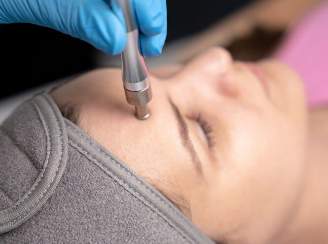 Tratamiento de limpieza facial profunda con microdermoabrasión en clínica dermatológica