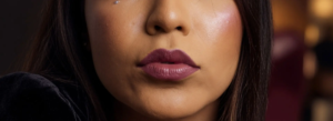 Resultado de relleno de labios con ácido hialurónico en clínica estética