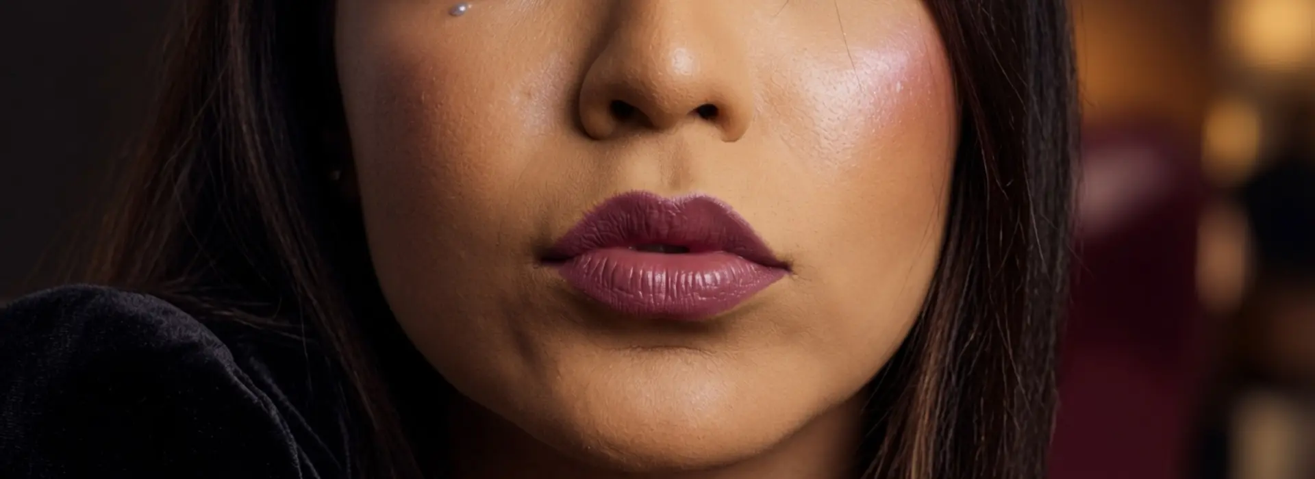 Resultado de relleno de labios con ácido hialurónico en clínica estética