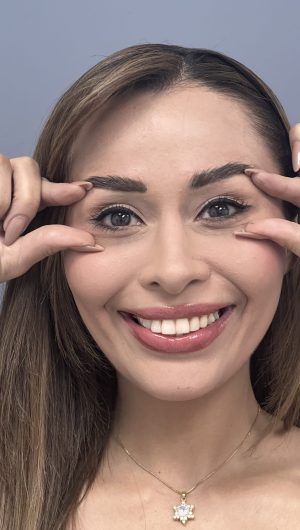 Mujer señalando arrugas alrededor de ojos candidata a tratamiento con toxina botulínica