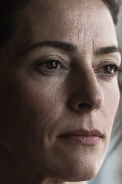 Rostro de mujer madura con signos de flacidez facial y líneas de expresión visibles, candidata a tratamiento de bioestimuladores de colágeno en clínica estética Dr. Perdomo