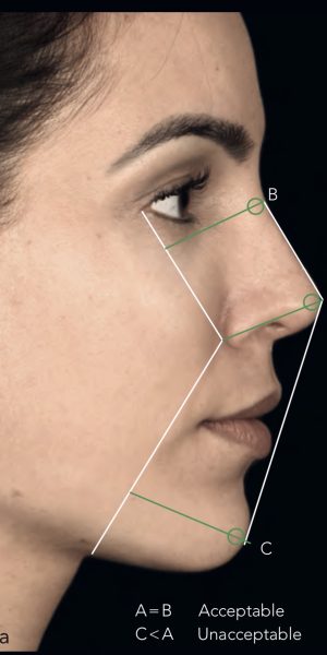 Análisis de proporciones faciales de perfil para planificación de armonización facial