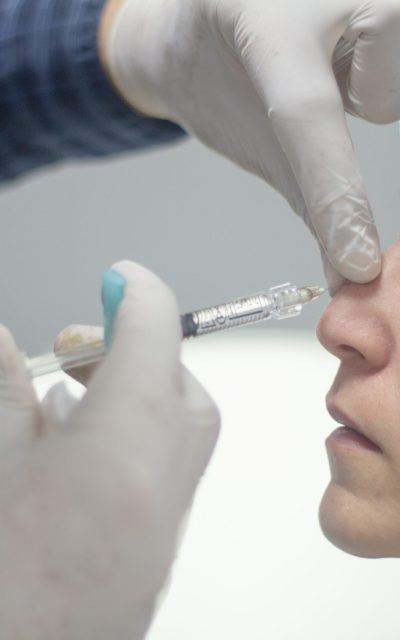 Procedimiento de rinomodelación con inyección de relleno en dorso nasal sin cirugía